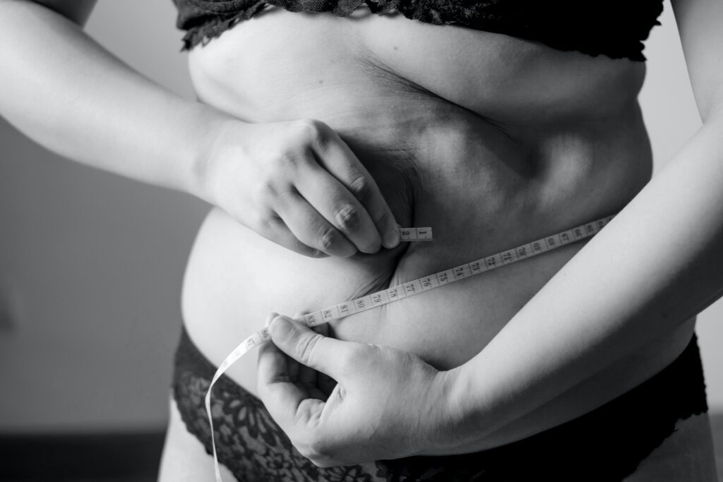 Weight Loss image, Bariatrics Surgery and information in Sydney New South wales